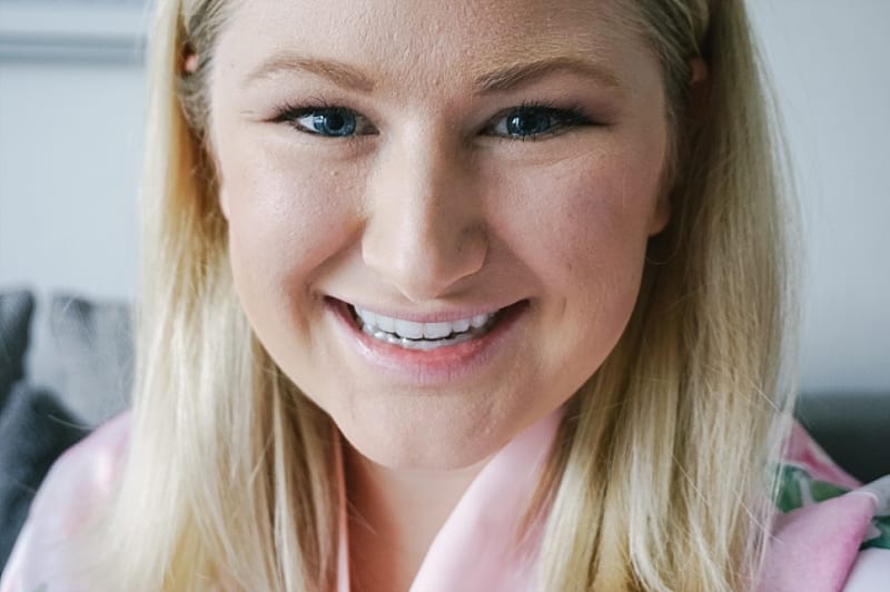 Smile Brilliant Teeth Whitening Testimonial | Madison Fichtl | Madison-fichtl.com