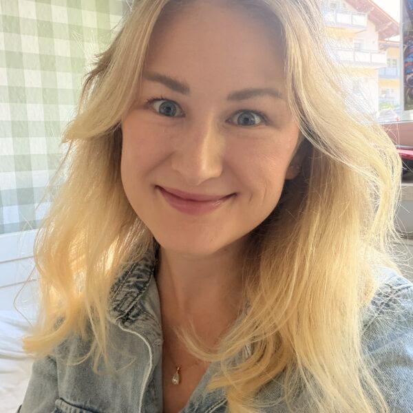 Treatment for Dark Circles Under Eyes: What Results Look Like After 4 Weeks